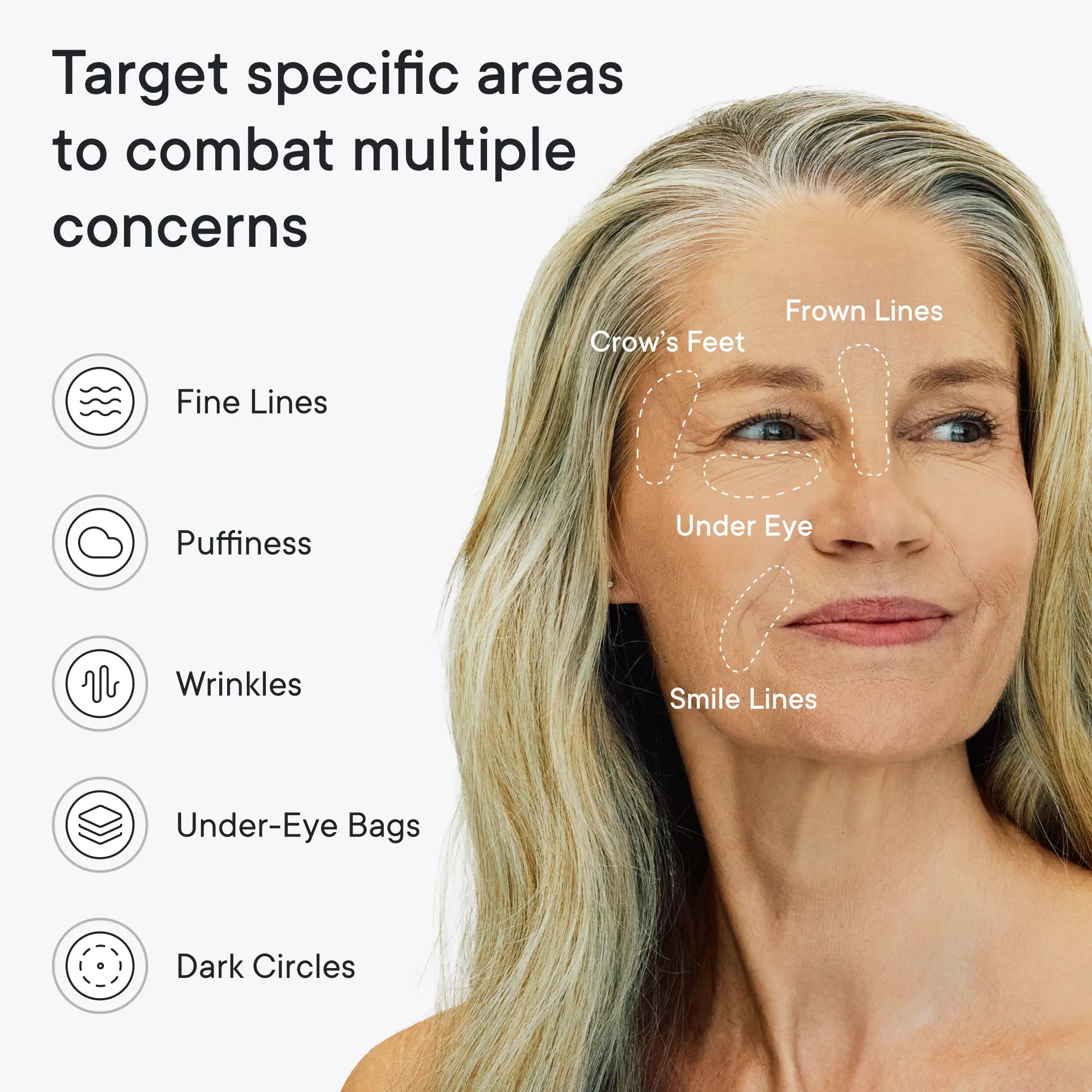 Faltenpflaster für die Nacht gegen Lachfalten und feine Linien, Anti-Aging-Gesichtspflaster mit Peptiden