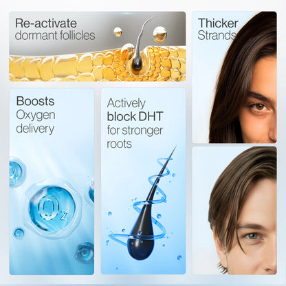 Be Bodywise Advanced Hair Density Roll-On Serum 25 ml | 5% Sägepalme, 3% Rosmarin, 1% Koffein-Herbasom & 3% Bockshornklee | Kopfhautserum für weniger Haarausfall | Männer & Frauen